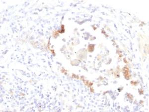 Anti-Blood Group Lewis y Mouse Monoclonal Antibody [Clone: LWY/1463]