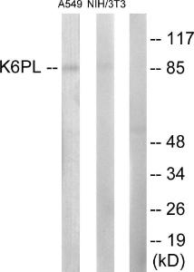 Anti-PFKL Rabbit Polyclonal Antibody