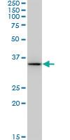 Anti-BDH1 Mouse Monoclonal Antibody [clone: 4B3]