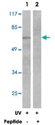 Anti-SYK Rabbit Polyclonal Antibody