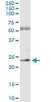 Anti-ASPH Polyclonal Antibody Pair