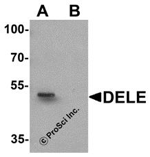 Western blot analysis of DELE in rat brain tissue lysate with DELE antibody at 1 &#956;g/ml in (A) the absence and (B) the presence of blocking peptide.