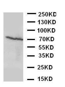 Anti-Estrogen Receptor beta Rabbit Polyclonal Antibody