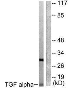 Western blot analysis of lysates from COS7 cells using Anti-TGF alpha Antibody The right hand lane represents a negative control, where the antibody is blocked by the immunising peptide