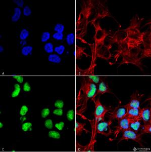 Immunocytochemistry/Immunofluorescence analysis of human neuroblastoma cell line (SK-N-BE, fixed in 4% formaldehyde for 15 min at room temperature, using Anti-Choline Acetyltransferase Antibody (A304944), at 1:100 for 60 minutes at room temperature