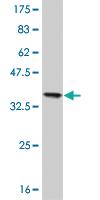 Anti-NME2 Mouse Monoclonal Antibody [clone: 1D3]