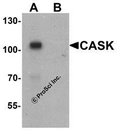 Western blot analysis of CASK in mouse brain tissue lysate with CASK antibody at 1 &#956;g/ml in (A) the absence and (B) the presence of blocking peptide.