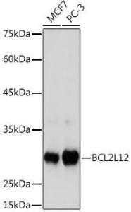 Western blot analysis of extracts of various cell lines, using Anti-BPR Antibody [ARC2334] (A306086) at 1:1,000 dilution. The secondary antibody was Goat Anti-Rabbit IgG H&L Antibody (HRP) at 1:10,000 dilution.