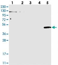 Anti-LGSN Rabbit Polyclonal Antibody