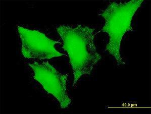 Anti-FOXO3 Mouse monoclonal antibody [clone: 2H2]