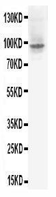 Anti-HIF-2-alpha Rabbit Polyclonal Antibody