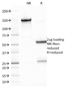 SDS-PAGE analysis of Anti-EBV LMP-1 Antibody [CS2] under non-reduced and reduced conditions; showing intact IgG and intact heavy and light chains, respectively. SDS-PAGE analysis confirms the integrity and purity of the antibody