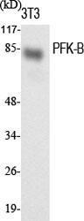 Anti-PFKL Rabbit Polyclonal Antibody