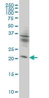 Anti-KIF26A Mouse Monoclonal Antibody [clone: 3C10]