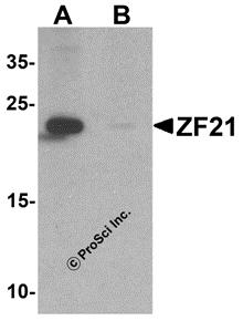 Western blot analysis of ZF21 in 3T3 cell tissue lysate with ZF21 antibody at 1 &#956;g/ml in (A) the absence and (B) the presence of blocking peptide.