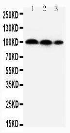 Anti-HIF-2-alpha Rabbit Polyclonal Antibody