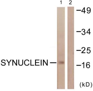 Western blot analysis of lysates from HUVEC cells using Anti-Synuclein Antibody. The right hand lane represents a negative control, where the Antibody is blocked by the immunising peptide