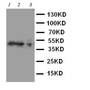 Anti-CCR4 Rabbit Polyclonal Antibody