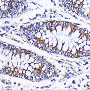 Immunohistochemistry analysis of paraffin-embedded human colon tissue using Anti-ICA69 Antibody (A307772) at a dilution of 1:100 (40x lens)