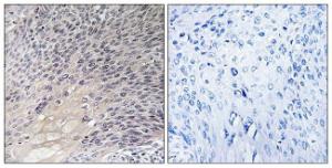 Anti-RhoGDI Rabbit Polyclonal Antibody