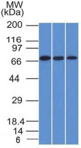 Western blot analysis of HeLa, A431, and HL-60 cell lysates using Anti-CD105 Antibody [ENG/1326]