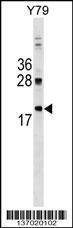 Anti-DNAJC5 Rabbit Polyclonal Antibody (HRP (Horseradish Peroxidase))