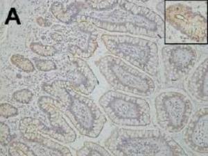 Anti-FCER1A antibody