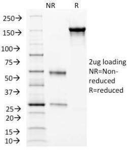 SDS-PAGE analysis of Anti-CD105 Antibody [ENG/1326] under non-reduced and reduced conditions; showing intact IgG and intact heavy and light chains, respectively. SDS-PAGE analysis confirms the integrity and purity of the antibody.