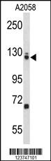 Anti-EFTUD2 Rabbit Polyclonal Antibody