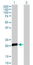 Anti-HBEGF Rabbit Polyclonal Antibody