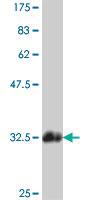 Anti-GPR62 Mouse Polyclonal Antibody