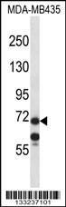 Anti-MID1 Rabbit Polyclonal Antibody (HRP (Horseradish Peroxidase))