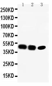 Anti-CCR6 Rabbit Polyclonal Antibody