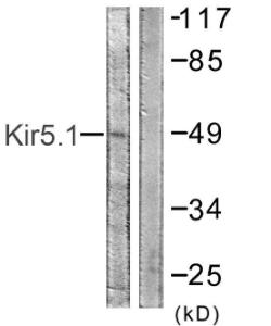 Anti-KIR5.1 Rabbit Polyclonal Antibody