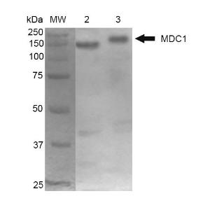 Western blot analysis of mouse Cortex and Cerebellum showing detection of 184 kDa MDC1 protein using Anti-MDC1 Antibody [P2B11] (A304945) at 1:1,000 for 2 hours room temperature Lane 1: MW ladder Lane 2: mouse Cortex Lane 3: mouse Cerebellum Load: 10  µg Block: 5% Skim Milk in 1X TBST