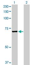 Anti-EPM2AIP1 Rabbit Polyclonal Antibody