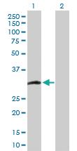 Anti-CCS Rabbit Polyclonal Antibody