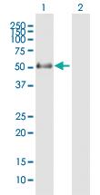 Anti-PNPLA3 Mouse Polyclonal Antibody