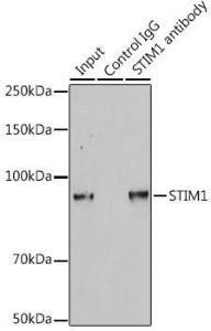 Anti-Stromal interaction molecule 1 Rabbit Polyclonal Antibody