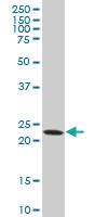 Anti-DTYMK Mouse Polyclonal Antibody