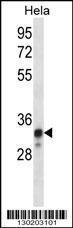 Anti-NDUFS8 Rabbit Polyclonal Antibody (FITC (Fluorescein Isothiocyanate))