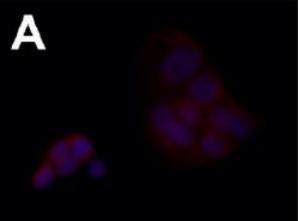 Anti-FCER1A antibody