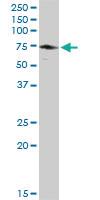 Anti-EPM2AIP1 Rabbit Polyclonal Antibody