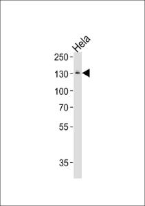 Anti-GTF2I Rabbit Polyclonal Antibody (AP (Alkaline Phosphatase))