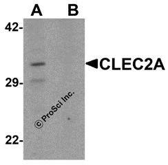 Western blot analysis of CLEC2A in K562 cell lysate with CLEC2A antibody at 1 &#956;g/ml in (A) the absence and (B) the presence of blocking peptide.