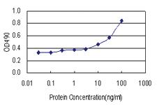 Anti-ZNF511 Polyclonal Antibody Pair