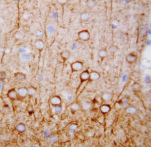 Anti-CaMKK Rabbit Polyclonal Antibody