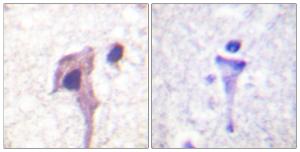 Anti-Synapsin I Rabbit Polyclonal Antibody