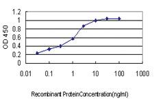 Anti-ACACA Mouse Monoclonal Antibody [clone: 6H5]