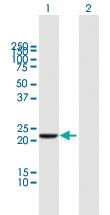 Anti-DTYMK Mouse Polyclonal Antibody